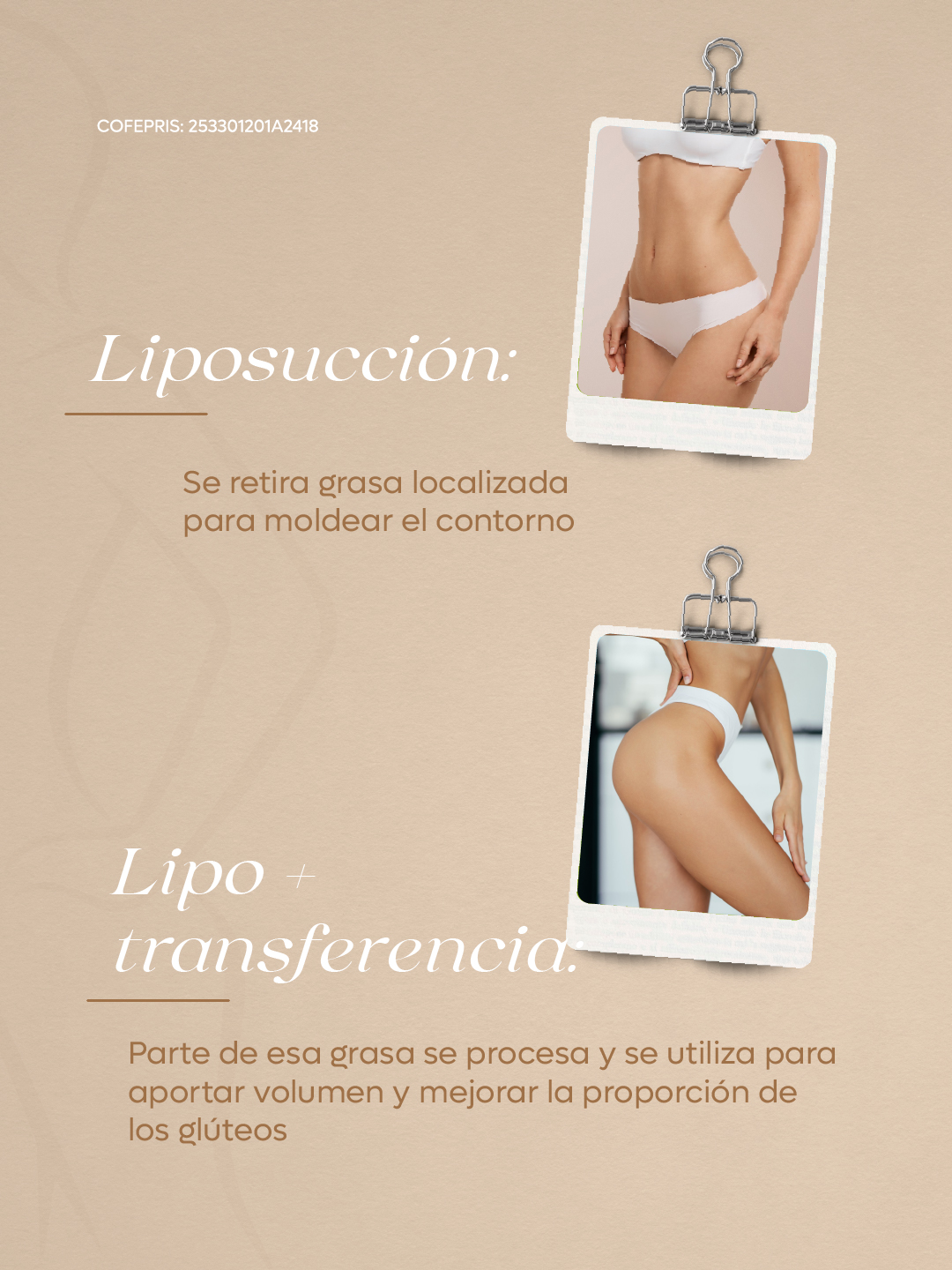 Diferencia entre liposucción y liposucción con transferencia de grasa